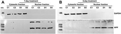 Glucocorticoids Preferentially Influence Expression of Nucleoskeletal Actin Network and Cell Adhesive Proteins in Human Trabecular Meshwork Cells